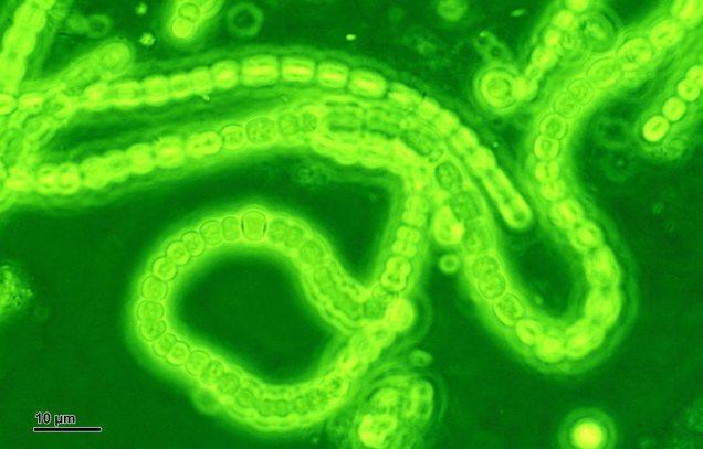 Cyanobacteria, planet Earth’s first terraformers. Image: Doc. RNDr. Josef Reischig, CSc. / Wikimedia